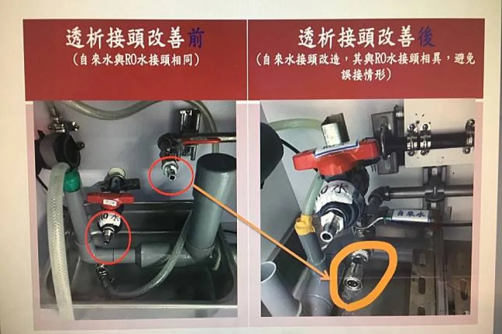 【洗腎管線又接錯】中國附醫坦承疏失　暫無病人有異狀