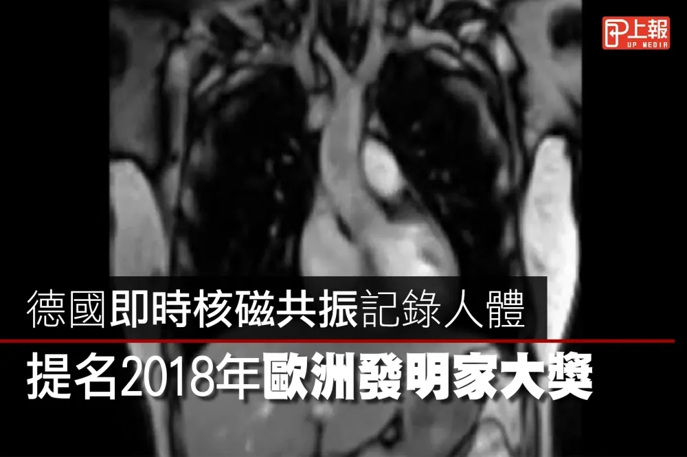【影片】德國即時核磁共振記錄人體　提名2018年歐洲發明家大獎