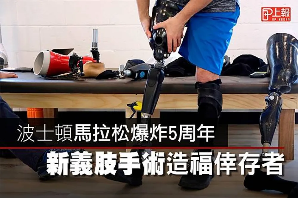 【影片】波士頓馬拉松爆炸5周年　新義肢手術造福倖存者