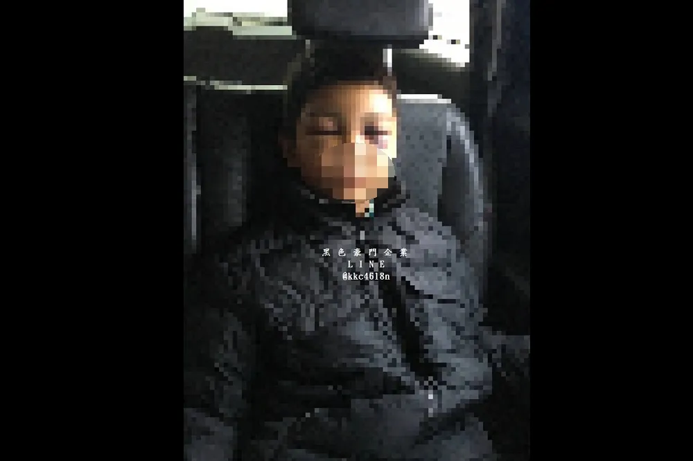 【繼父出拳】偷喝同學牛奶就暴打　苗栗男童鼻青臉腫上小黃