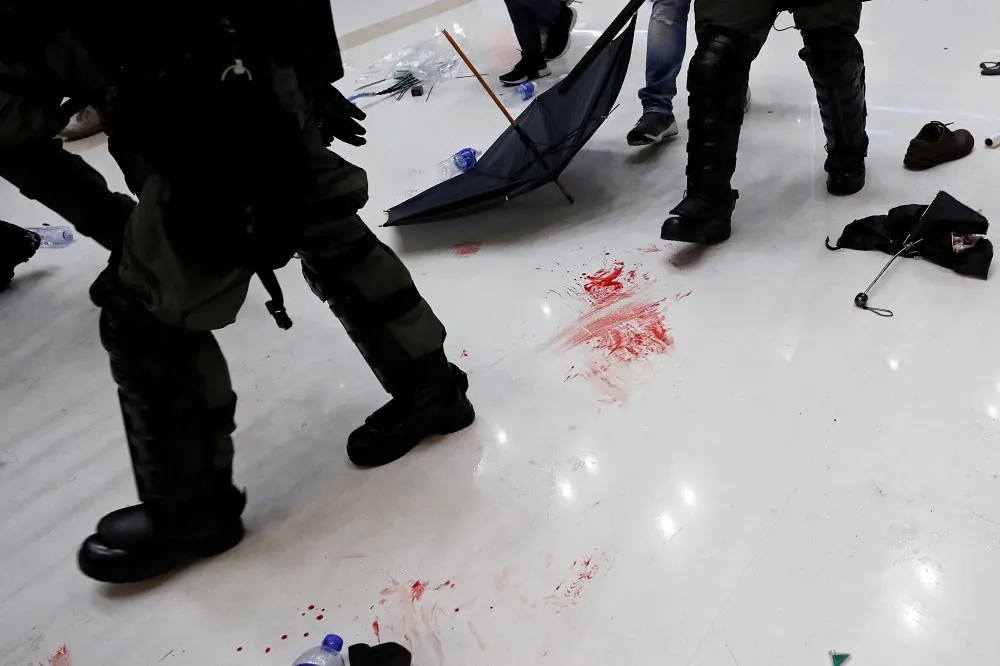 【香港反送中】沙田遊行爆發警民衝突　警員手指受傷見骨、示威者倒地急需氧氣罩