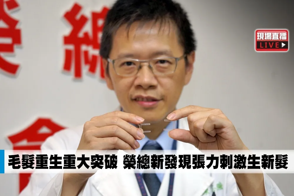 【直播】毛髮重生重大突破　榮總新發現張力刺激生新髮