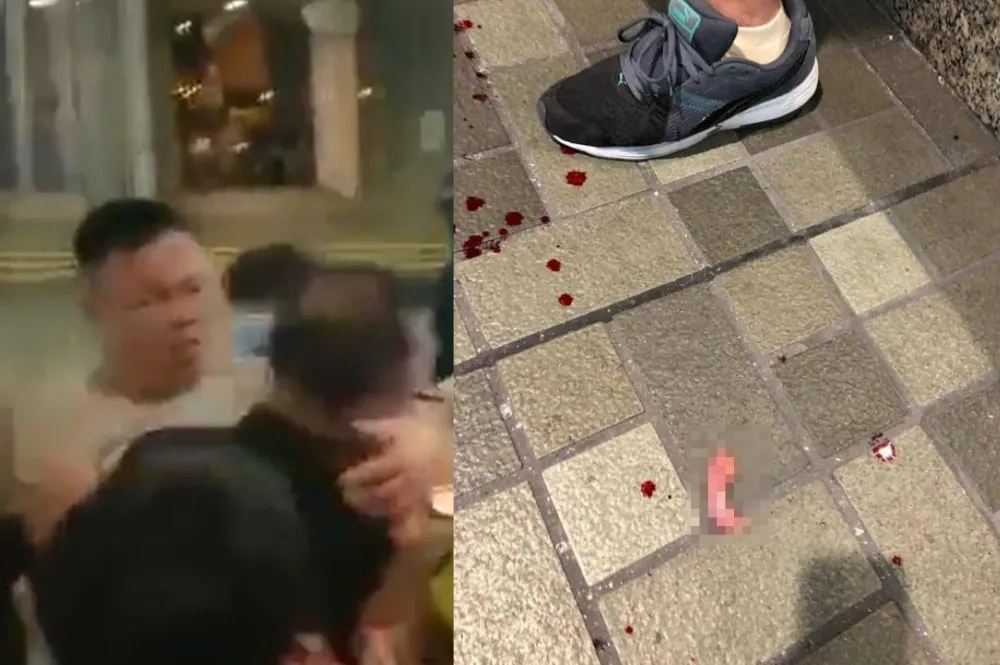 香港示威者遭男子持利刀刺穿肺　3人中刀2人命危、議員左耳遭咬掉