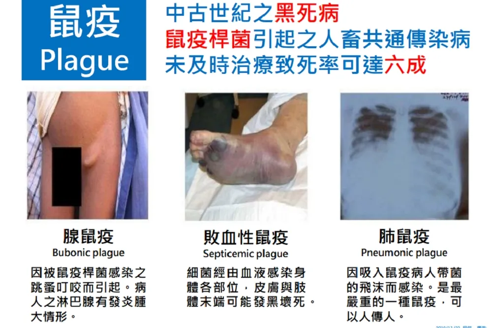 中國鼠疫再爆第4例　疾管署：赴中國疫區應安排衛生住所