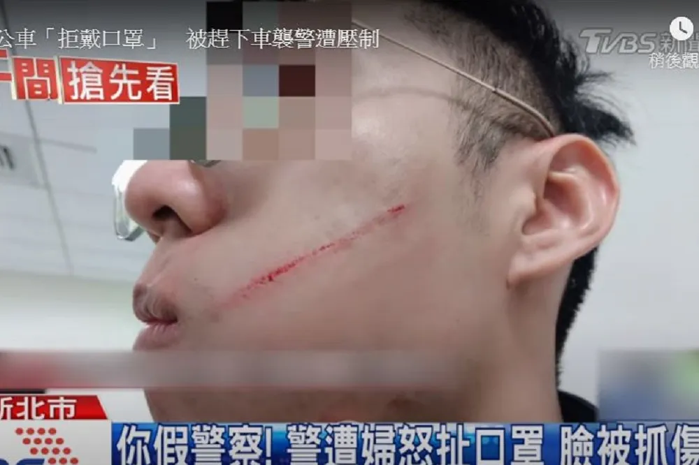 搭公車拒戴口罩失控襲警「臉留10公分傷」　新北黃婦遭上銬移送