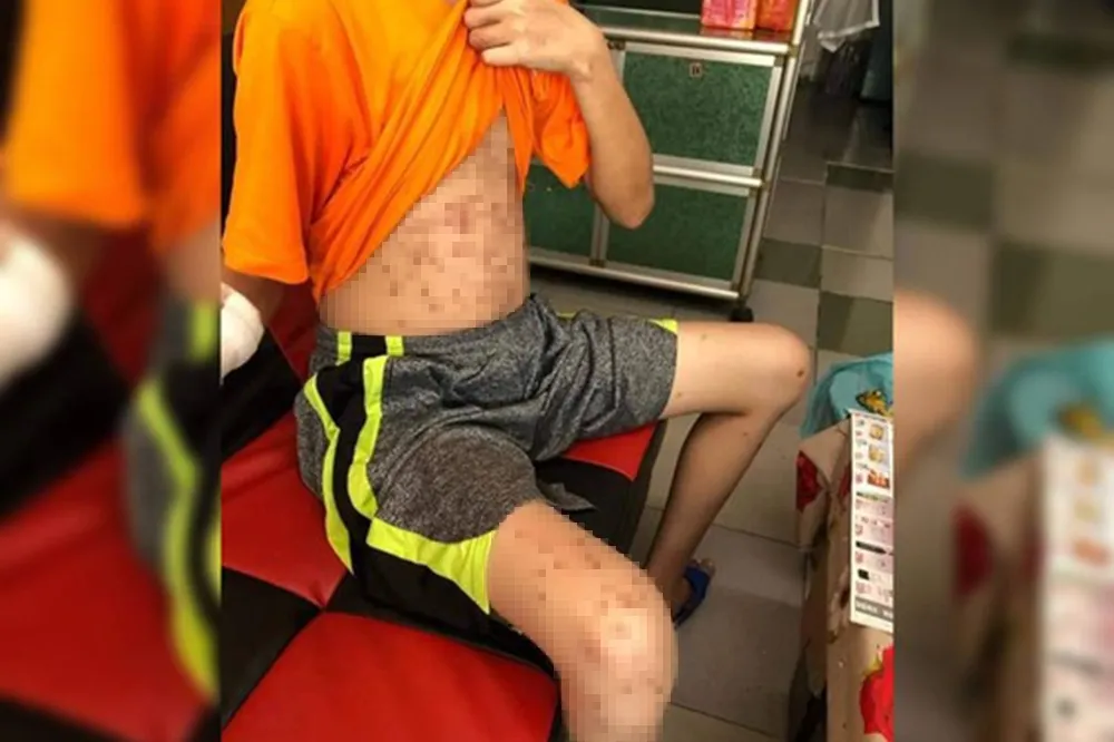 變態雇主吸毒後凌虐17歲打工少年　狠射BB彈還逼吃穢物及菸蒂