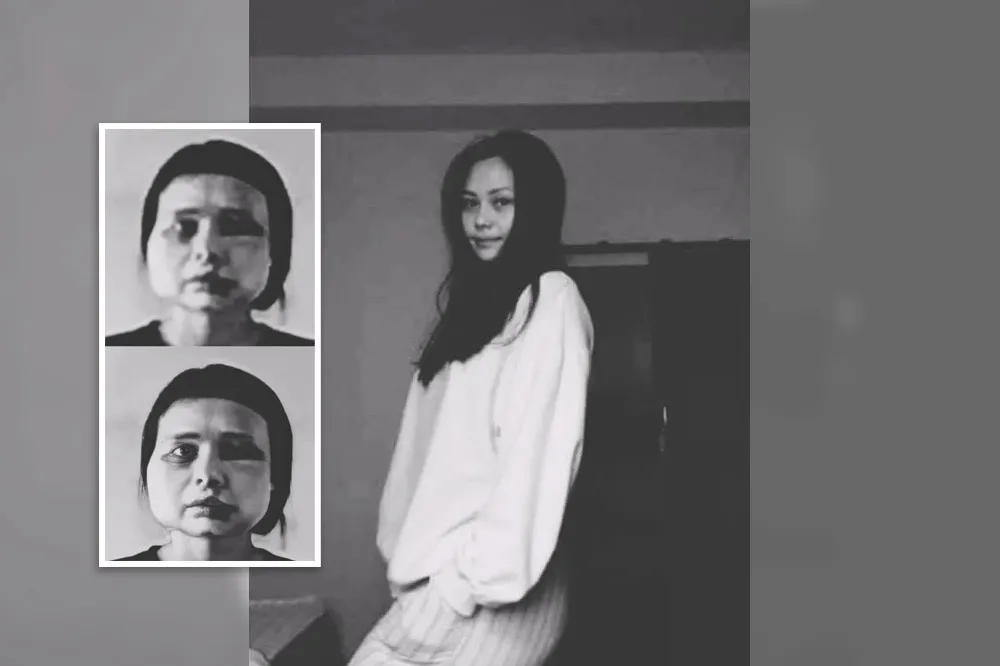 【緬甸政變】舞蹈老師遭酷刑毀容　逃亡軍人：他們殺任何想殺的人