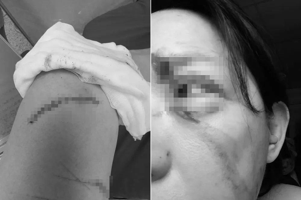 挖眼案翻版！女遭勸戴罩怒刺美工刀「當天就交保」　被害人心寒求嚴辦