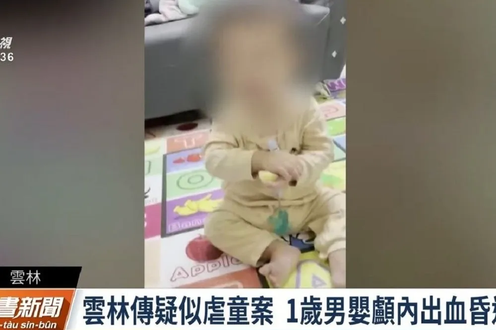 無照保母辯11月大男嬰「爬高2米」摔成顱內出血　涉虐遭送辦