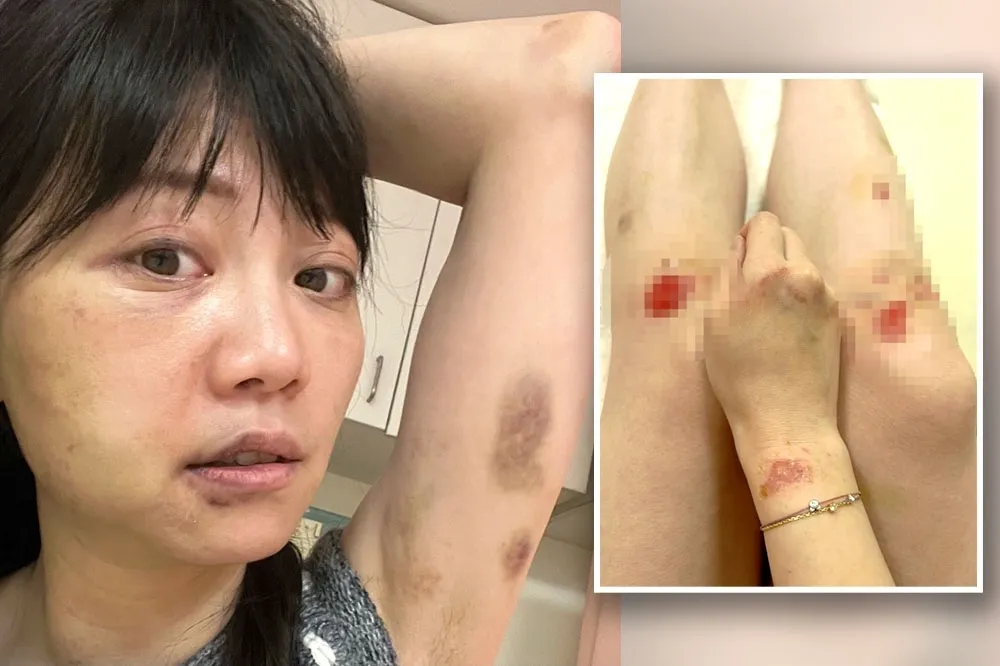 恐怖情人「確診」！專家曝3症頭5情勒套路　不想相愛相殺請快逃