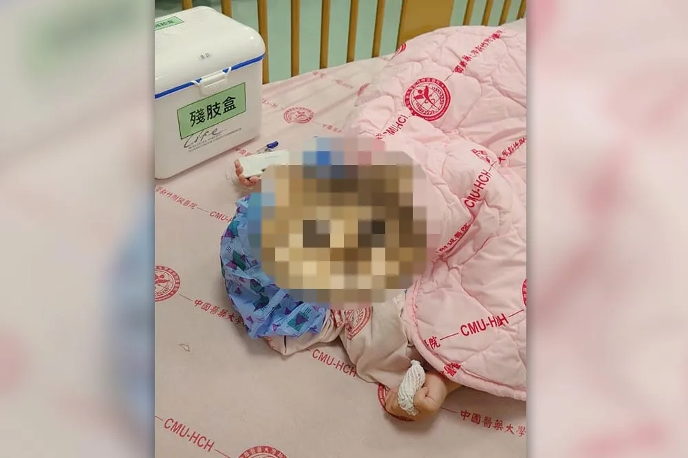 太詭異！2歲童戲水竟遭幫浦斷指　母發文找真相