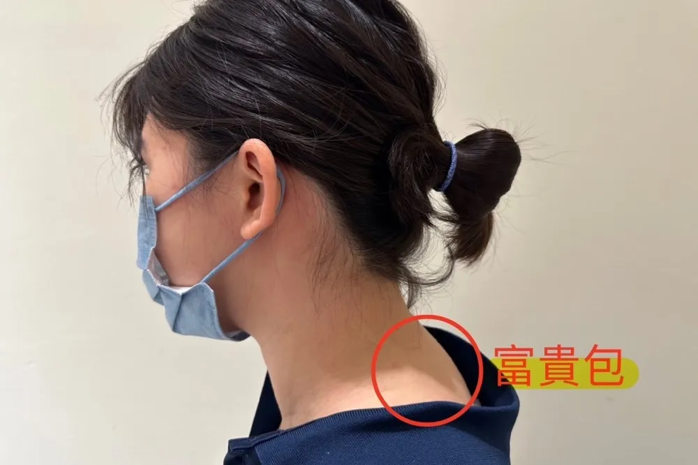 上班坐姿不良？物理治療師教你簡單運動　改善脖子後方「富貴包」