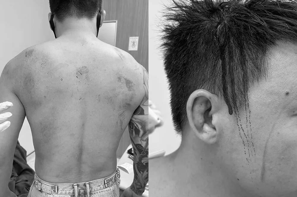Toyz遭超哥爆揍後首發聲　貼2千字文反嗆：你的醋飯夠難吃