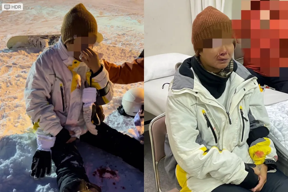 台女赴日滑雪遭港籍情侶撞傷縫7針　網友怒PO文肉搜肇事者