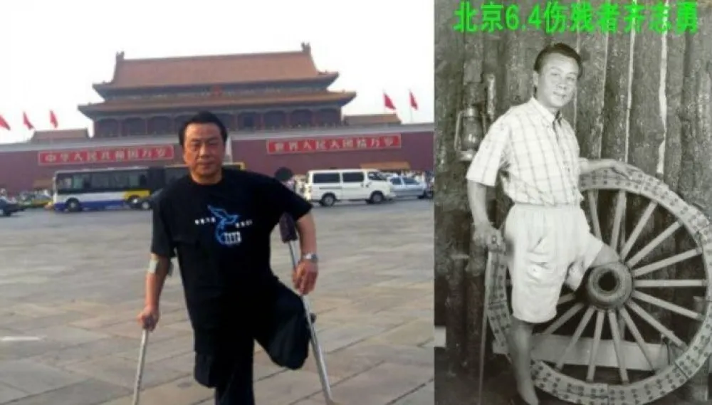 齊志勇，你把你的腿留在了廣場