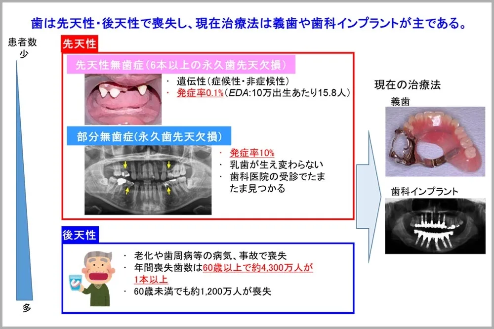 日本首創「牙齒再生」藥物9月臨床試驗　未來不用植牙！