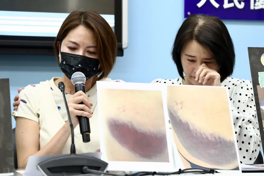 控訴遭鍾佳濱2次抱摔跌倒　陳菁徽曝光臀部瘀青照