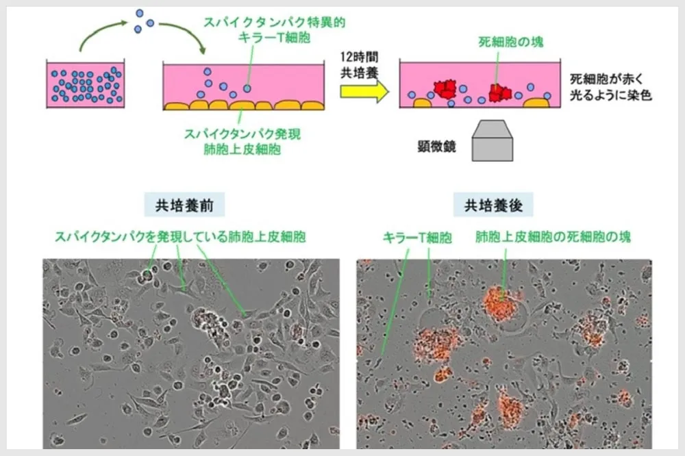 【有片】新冠重症治療現曙光　日本京都大學新藥可望2029年問世