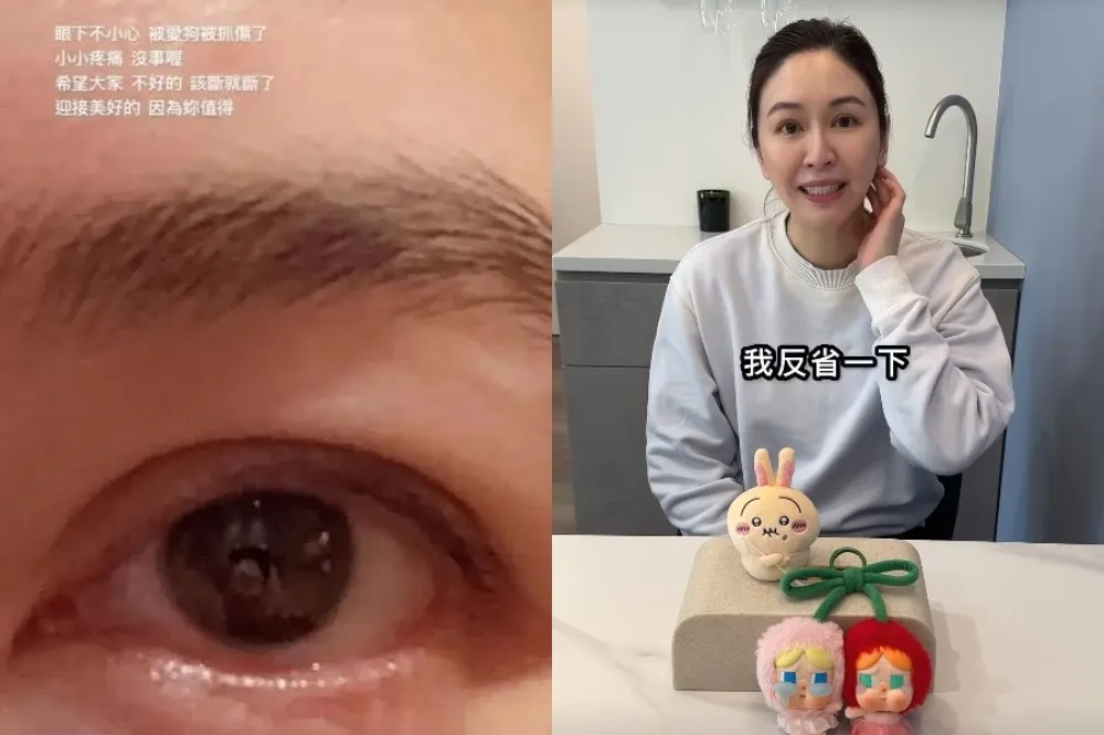 蔡依珊貼眼傷照嘆「該斷就斷」又刪文　本人親拍影片釋疑：對工作有感而發